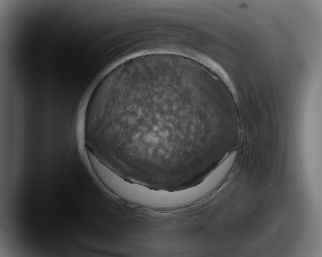 X0000087531528200705181021