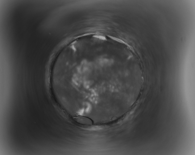X0000087530149200705251706
