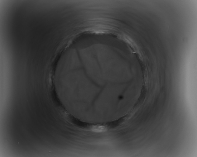 X0000087530169200705251707