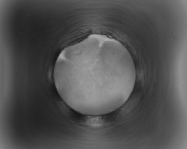 X0000087530185200705251707