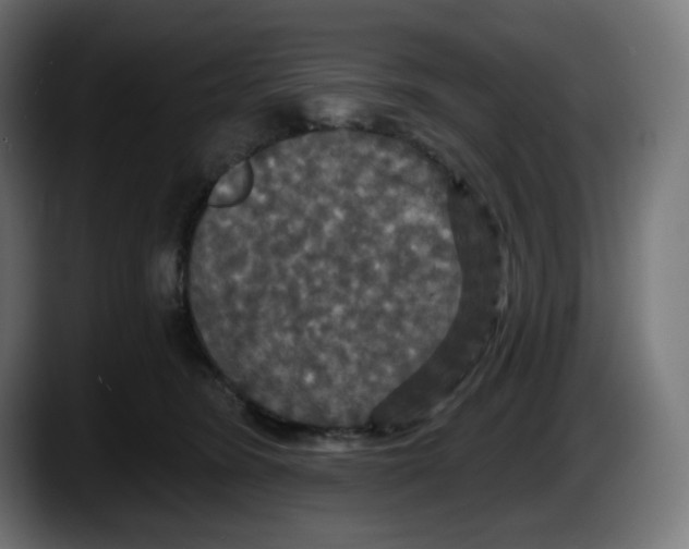 X0000087530420200705251703