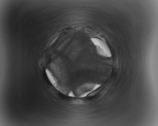 X0000087530572200705251702