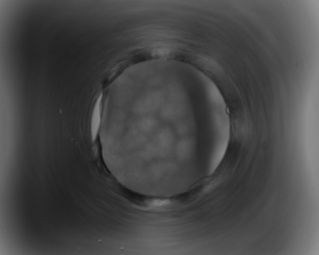 X0000087530575200705251702