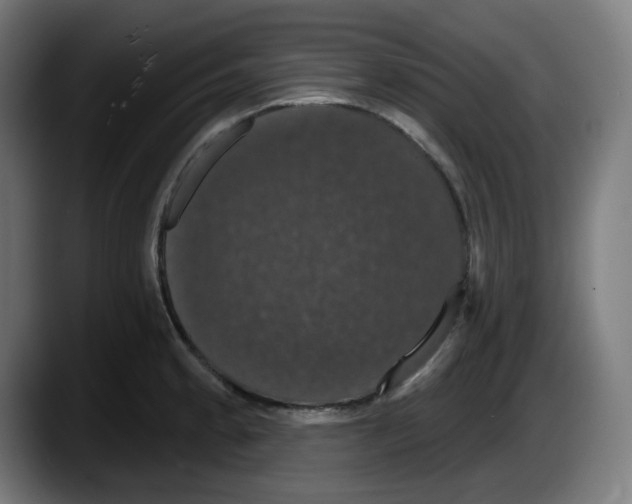 X0000087531189200705251653