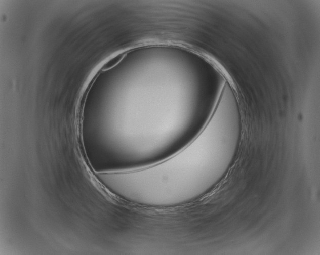 X0000087541148200704270917