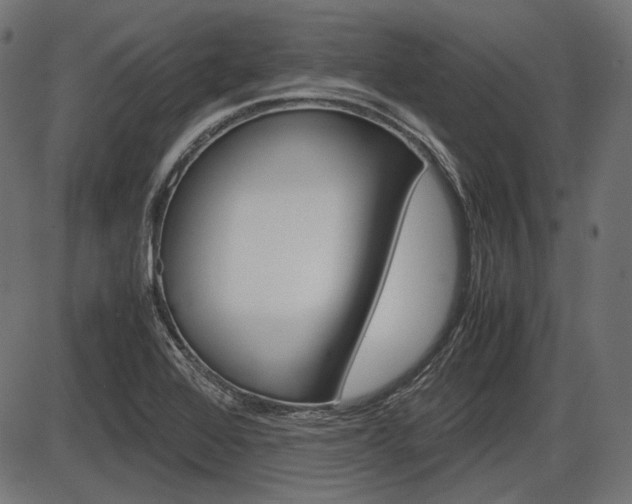 X0000087541368200704270913