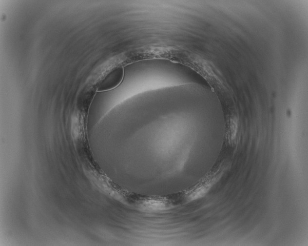 X0000087540236200704271240
