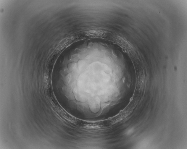 X0000087540749200704271232