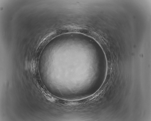 X0000087541157200704271225