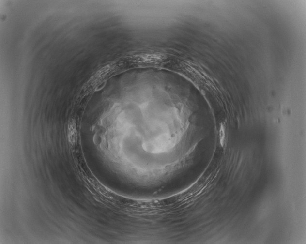 X0000087541395200704271220
