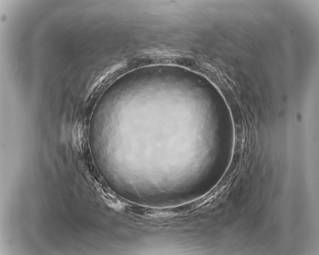 X0000087541157200705041255