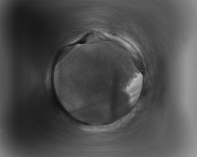 X0000087540009200705181057