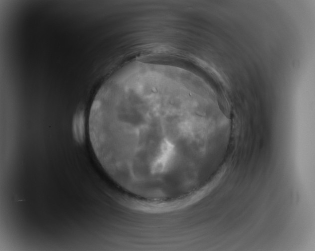 X0000087540014200705181057