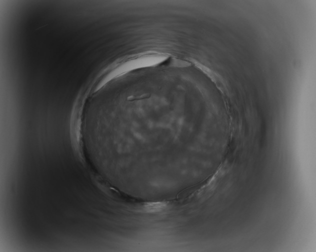 X0000087540050200705181056