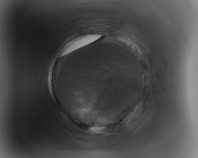 X0000087540051200705181056