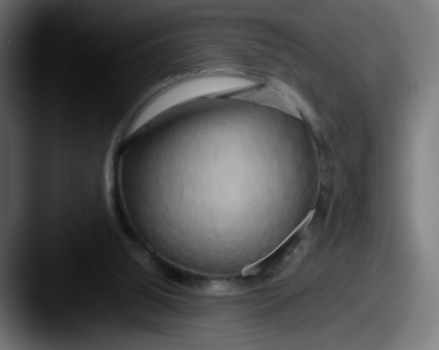 X0000087540060200705181056