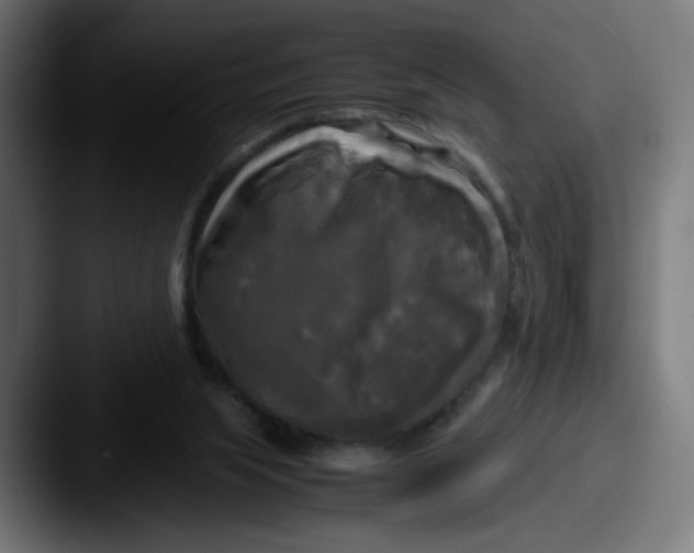 X0000087540063200705181056