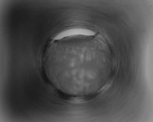 X0000087540078200705181056