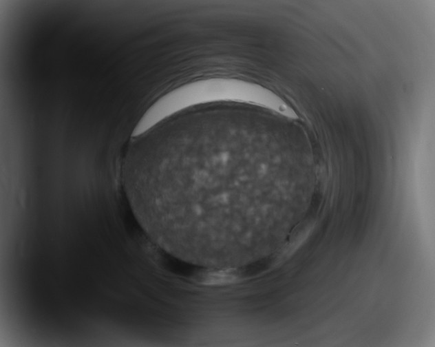 X0000087540093200705181056