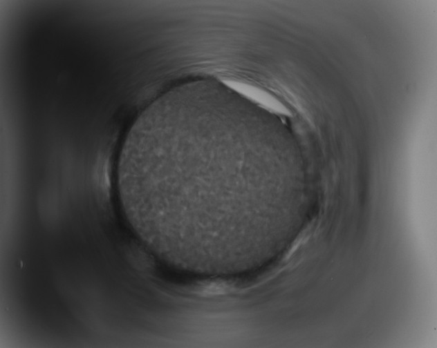 X0000087540115200705181055