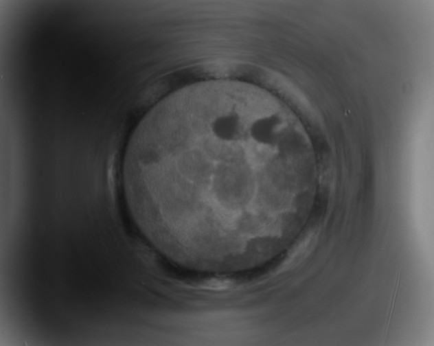 X0000087540119200705181055