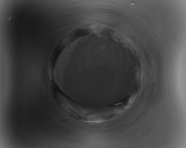 X0000087540137200705181055