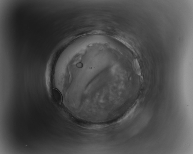 X0000087540149200705181055