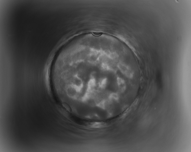 X0000087540151200705181055