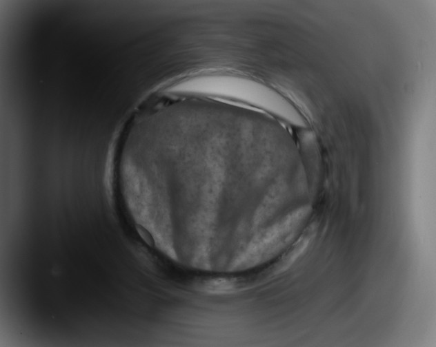 X0000087540156200705181055