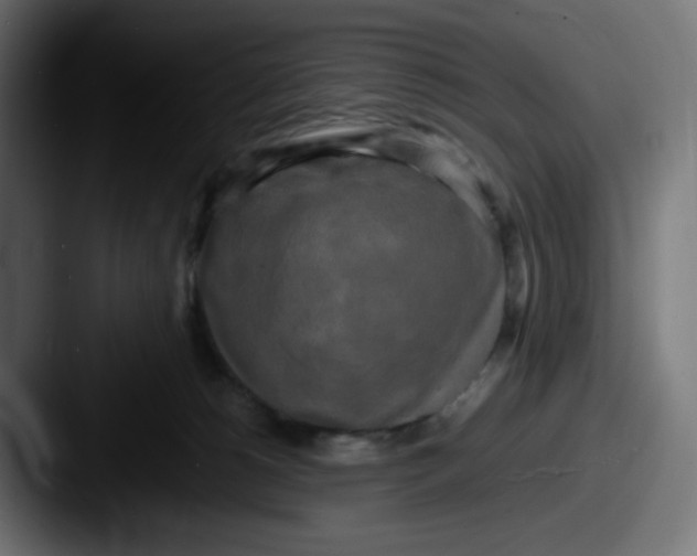 X0000087540180200705181055