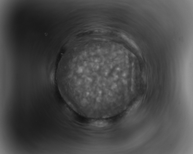 X0000087540185200705181055