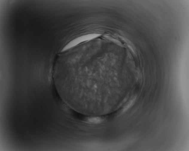 X0000087540189200705181055