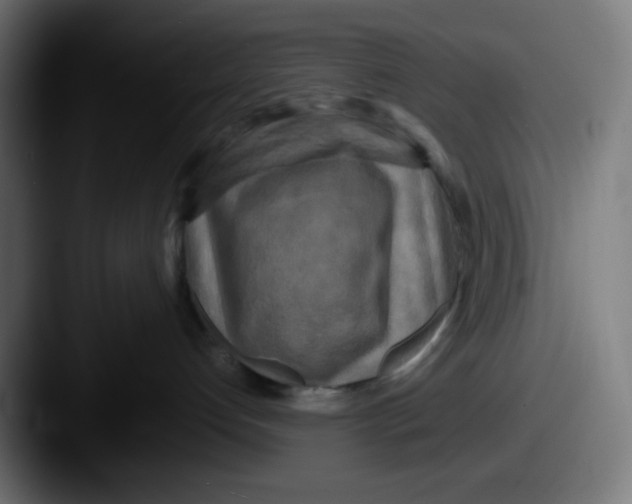 X0000087540192200705181055