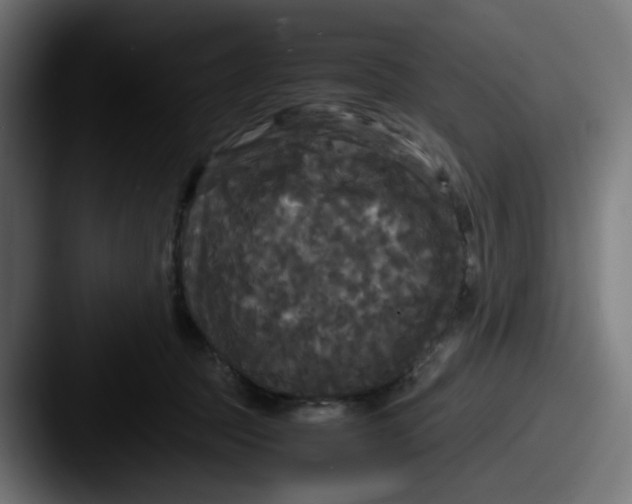 X0000087540369200705181053