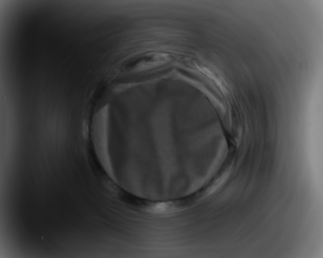 X0000087540382200705181053