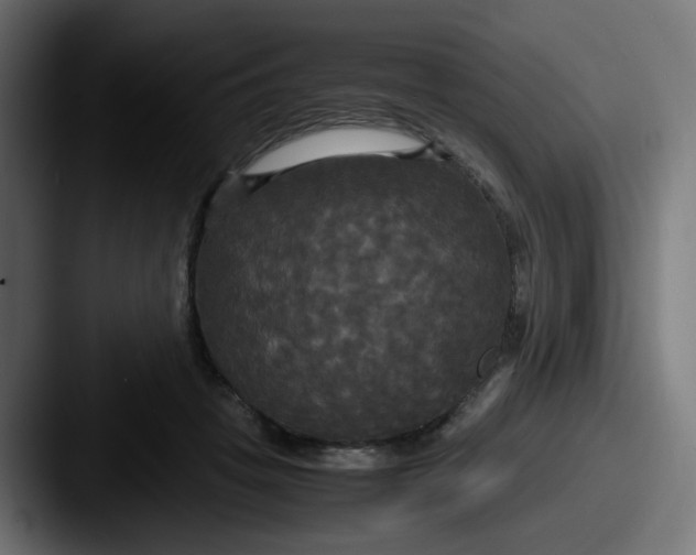 X0000087540457200705181051