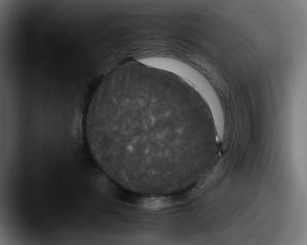 X0000087540461200705181051