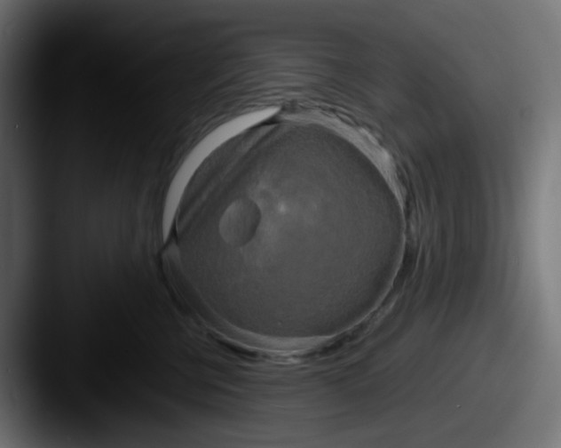 X0000087540570200705181051