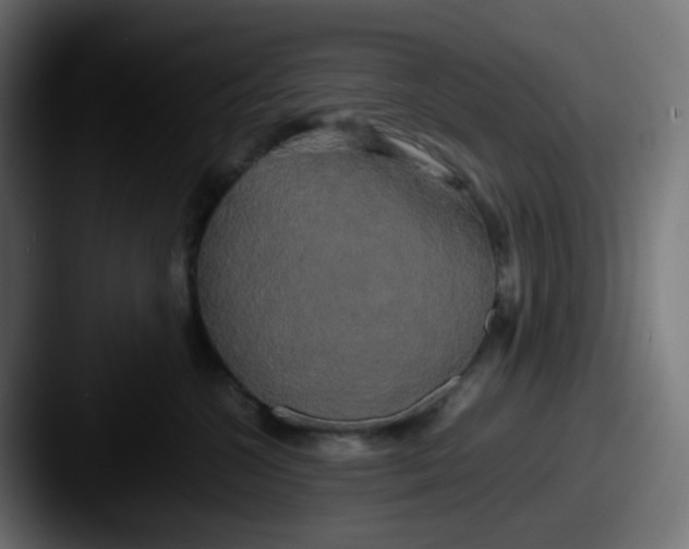 X0000087540572200705181051