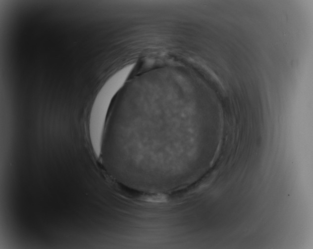 X0000087540576200705181051