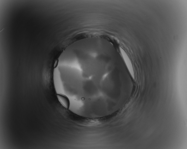 X0000087540715200705181048