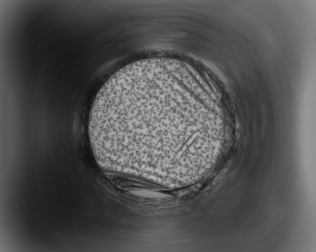 X0000087540872200705181047