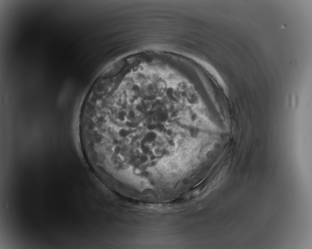 X0000087540903200705181046