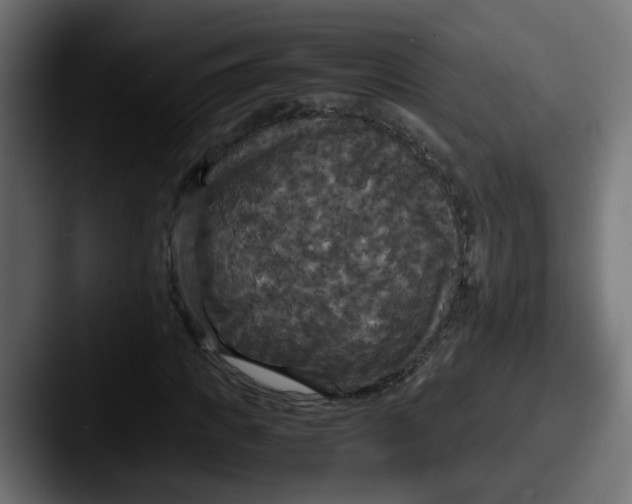 X0000087540917200705181045