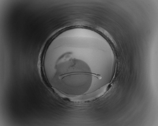 X0000087541024200705181044