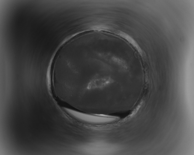 X0000087541032200705181045