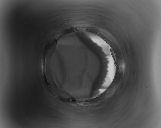 X0000087541060200705181044