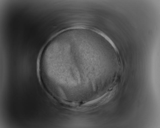 X0000087541101200705181044