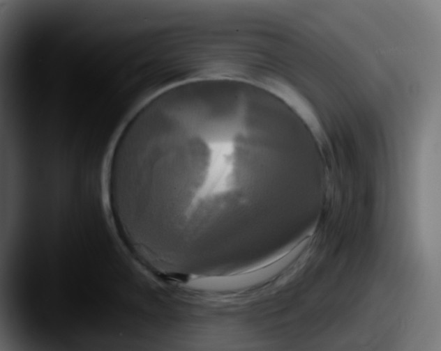 X0000087541102200705181044