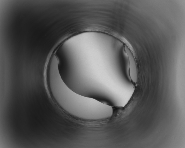 X0000087541138200705181044